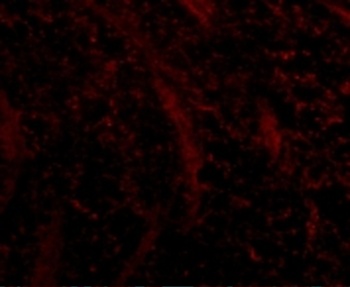 TOM70 Antibody