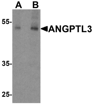 ANGPTL3 Antibody