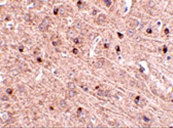 TOM70 Antibody