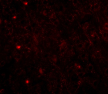 TOMM70A Antibody