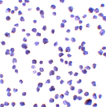 ALSFTD Antibody