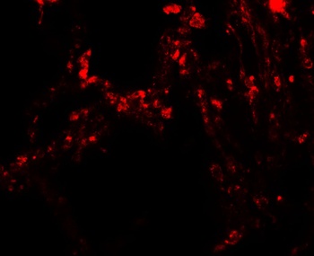 TRPV4 Antibody