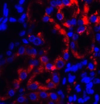 TRPV4 Antibody