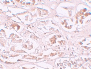 ALKBH2 Antibody