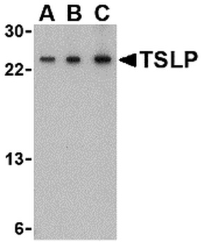 TSLP Antibody