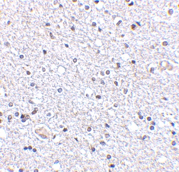 TSLP Antibody