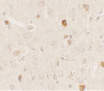 AKT1S1 Antibody