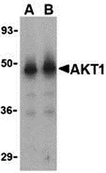 Akt1 Antibody