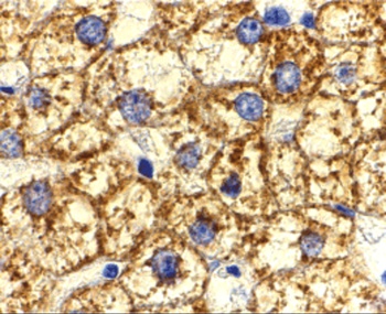 Akt1 Antibody