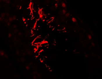 AKAP4 Antibody
