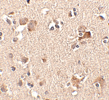 AIPL1 Antibody