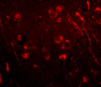 AIPL1 Antibody