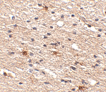 AIPL1 Antibody