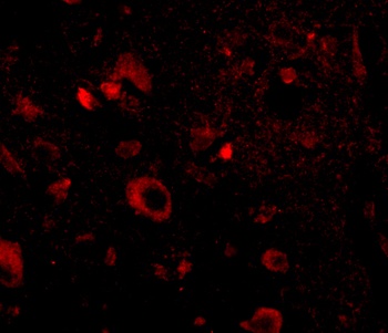 Aipl1 Antibody