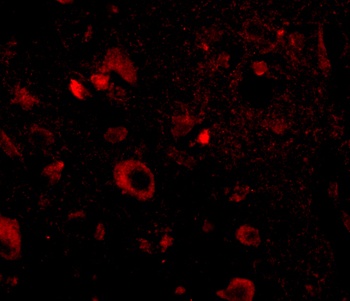 AIPL1 Antibody