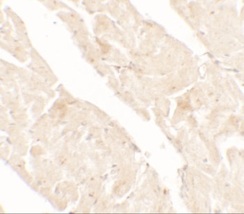 AIMP2 Antibody