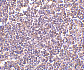 CD5L Antibody