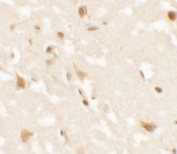 AIG1 Antibody