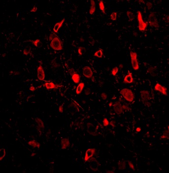 TSLP Antibody