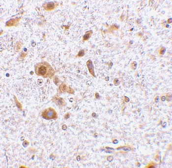 TSLP Antibody