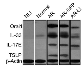 TSLP Antibody