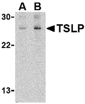 TSLP Antibody