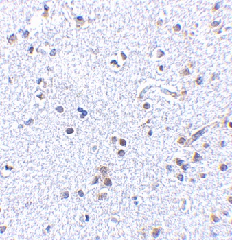 TSLP Antibody