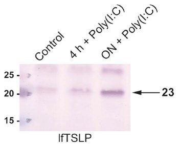 TSLP Antibody