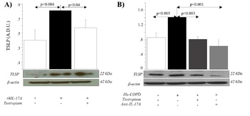 TSLP Antibody