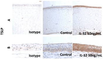 TSLP Antibody