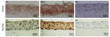 TSLP Antibody