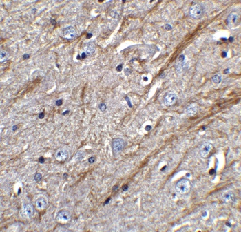 TNFSF12 Antibody