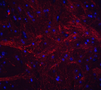 TWEAK Antibody