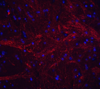 TNFSF12 Antibody