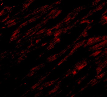 UNG1 Antibody