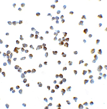 VCL Antibody