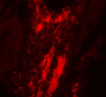 VCL Antibody