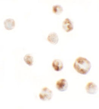 AFAP1L1 Antibody