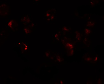 AFAP1L1 Antibody