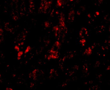 AFAP1L2 Antibody