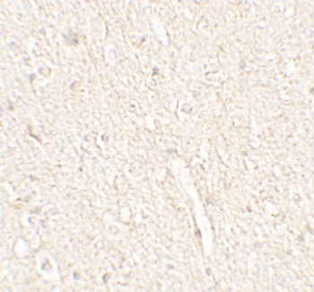 ENHO Antibody