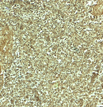ADRM1 Antibody