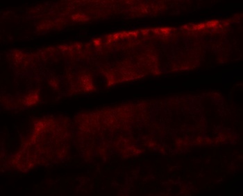 ADORA2B Antibody