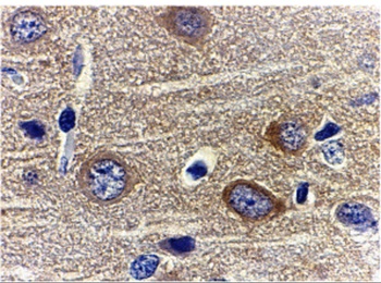 ADIPOQ Antibody