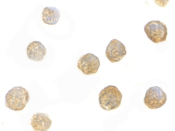ADAP Antibody