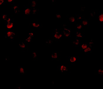 ADAP Antibody