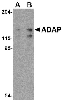 FYB Antibody