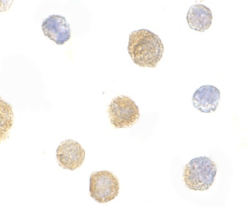 ADAP Antibody
