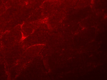 ADAMTSL5 Antibody