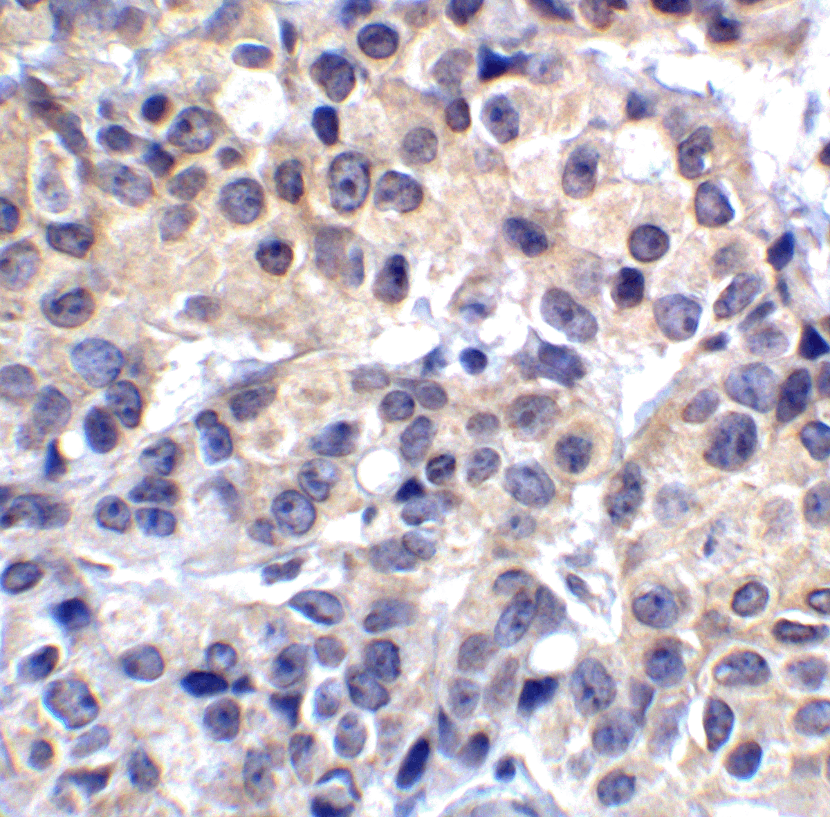 VISTA Antibody [4C4]